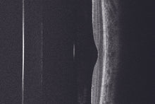 Cargar la imagen en el visor de la galería, HOCT-Biometry Module