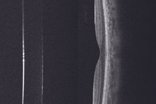 Cargar la imagen en el visor de la galería, HOCT-Biometry Module