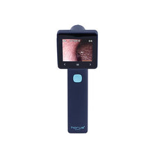 Cargar la imagen en el visor de la galería, Digital Otoscope