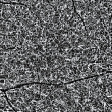 Cargar la imagen en el visor de la galería, H Angio Module
