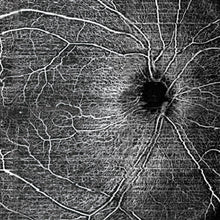 Cargar la imagen en el visor de la galería, H Angio Module
