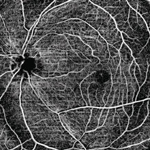 Cargar la imagen en el visor de la galería, H Angio Module
