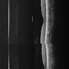 Cargar la imagen en el visor de la galería, HOCT-Biometry Module