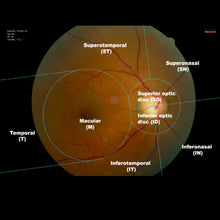 Cargar la imagen en el visor de la galería, Software de Inteligencia Artificial