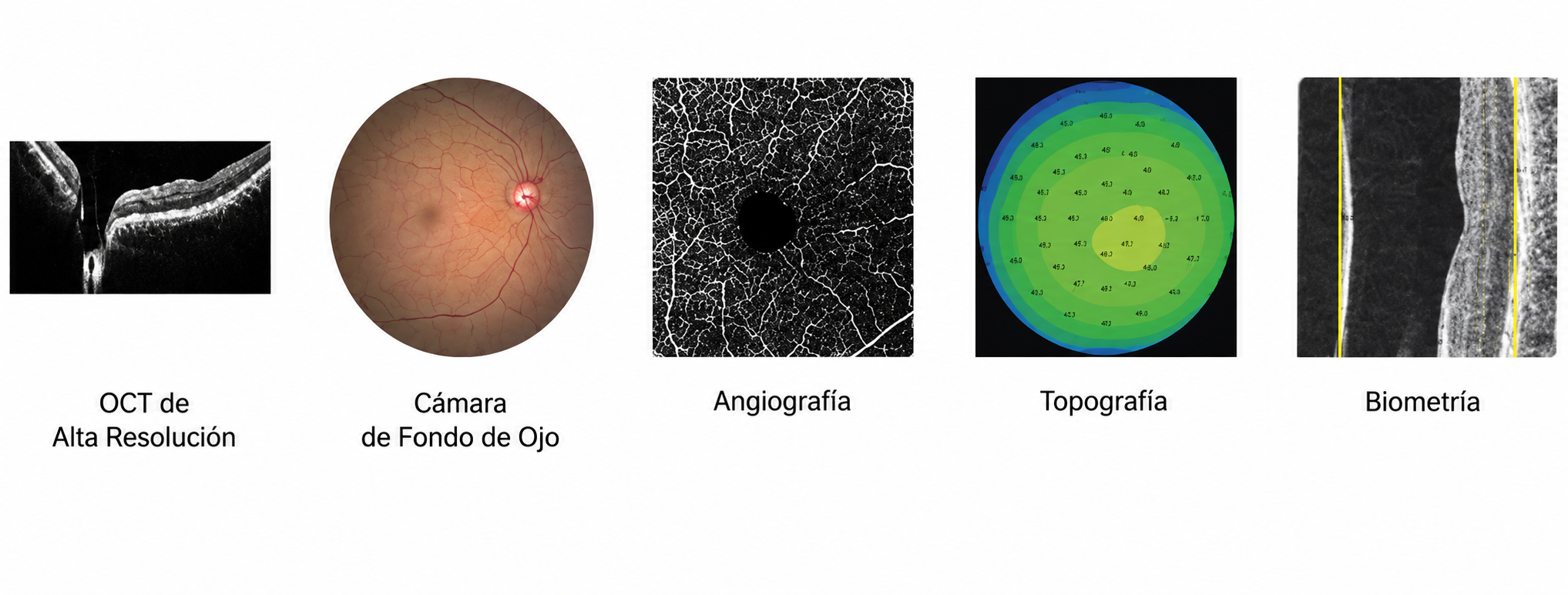 Huvitz Tomógrafo de Coherencia Óptica con Fundus HOCT-1F (80) — imagen de detalle 10 de 13