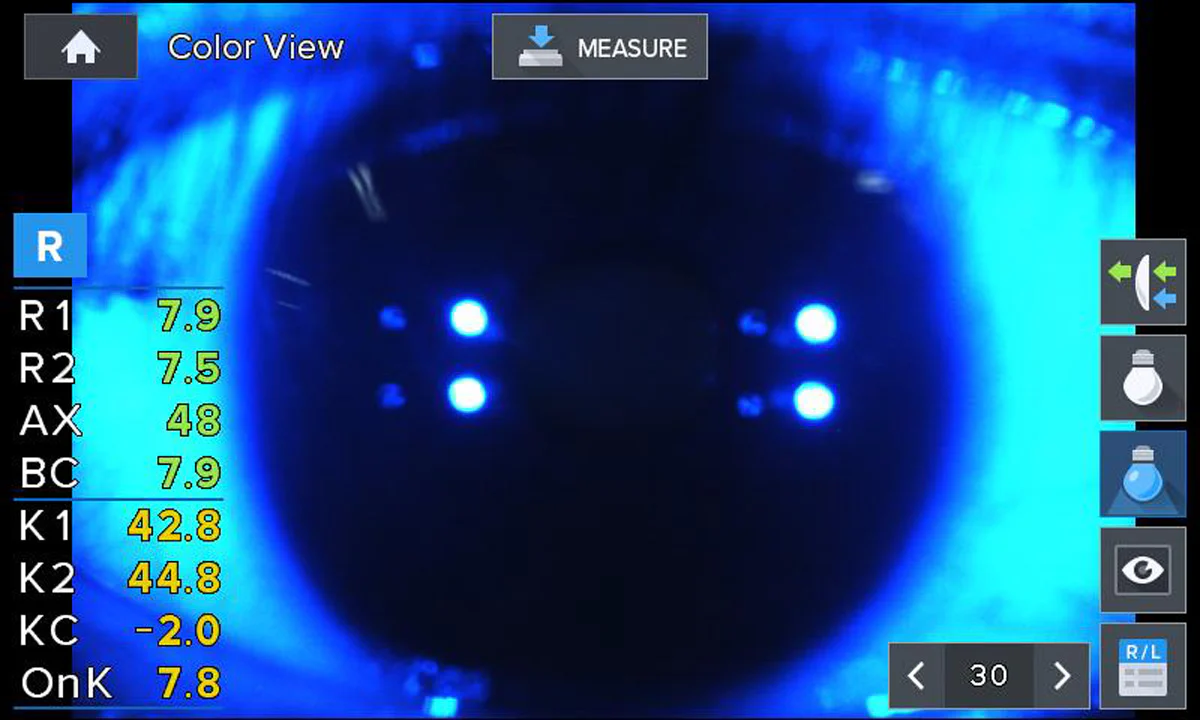 Huvitz Autorrefractor / Queratómetro HRK-1 — imagen de detalle 9 de 17