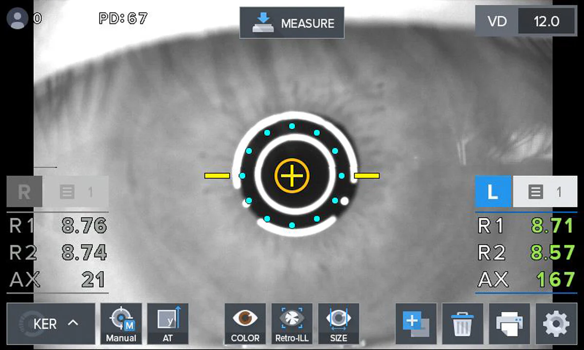 Huvitz Autorrefractor / Queratómetro HRK-1 — imagen de detalle 4 de 17