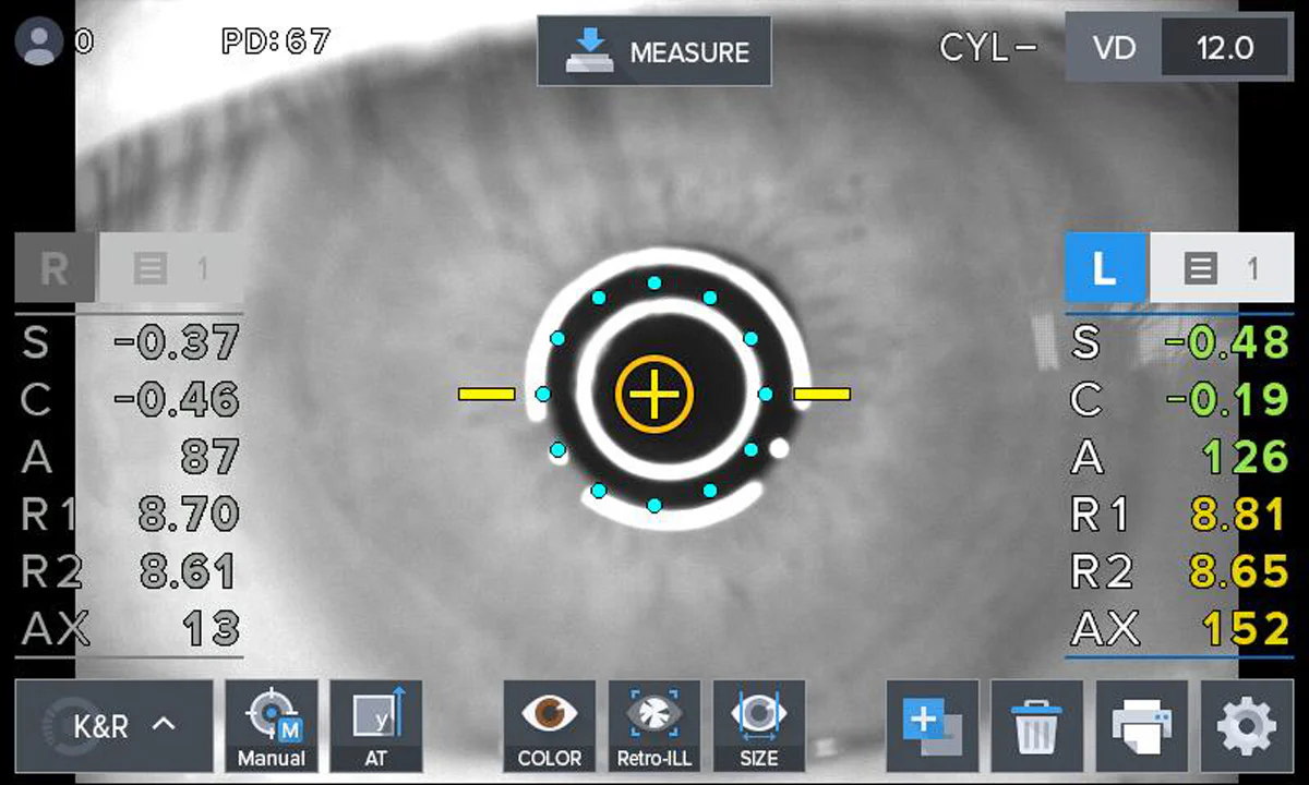 Huvitz Autorrefractor / Queratómetro HRK-1 — imagen de detalle 5 de 17