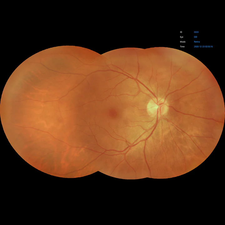 Ezer Cámara Retinal EFC-2600 — vista 42 de 50