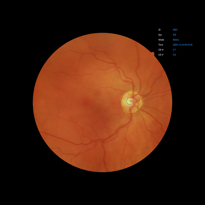 Ezer Cámara Retinal EFC-2600 — vista 40 de 50