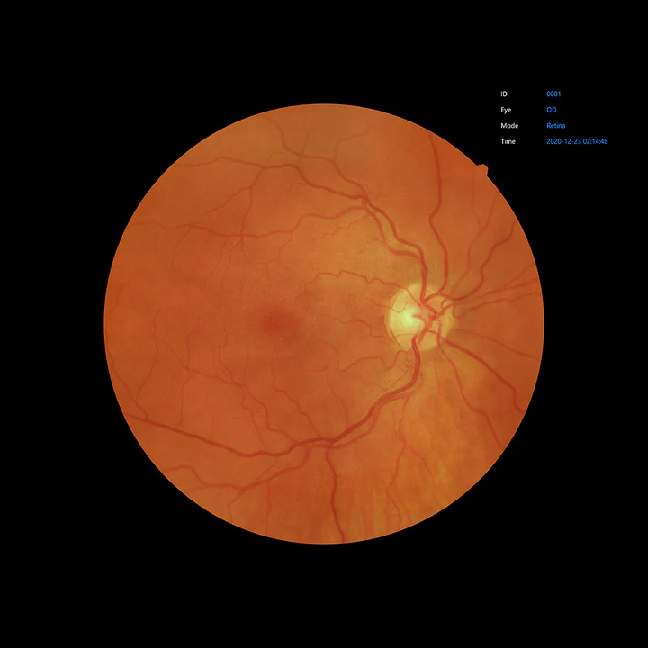 Ezer Cámara Retinal EFC-2600 — vista 39 de 50