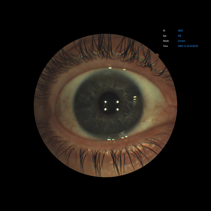 Ezer Cámara Retinal EFC-2600 — vista 33 de 50