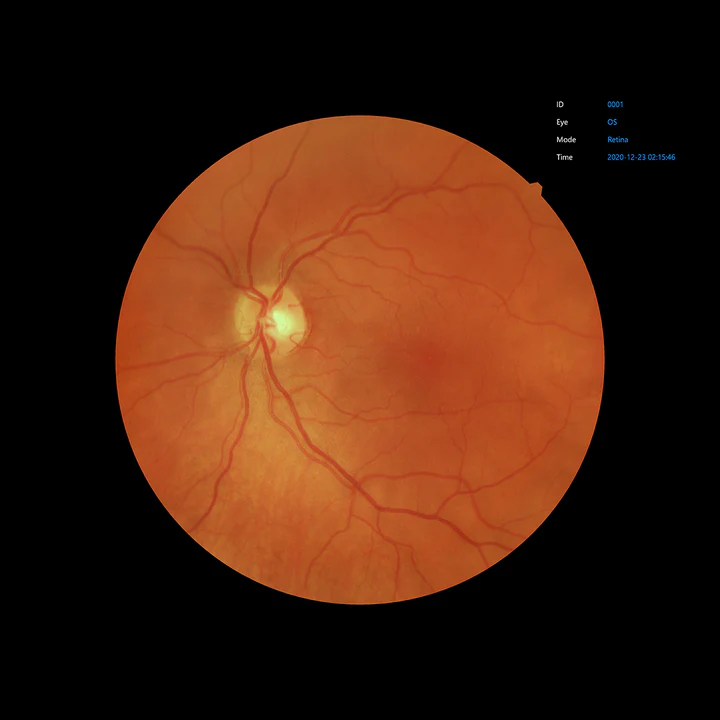 Ezer Cámara Retinal EFC-2600 — vista 25 de 50