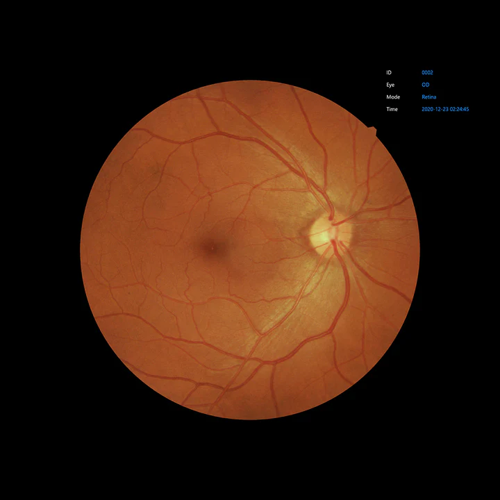 Ezer Cámara Retinal EFC-2600 — vista 23 de 50