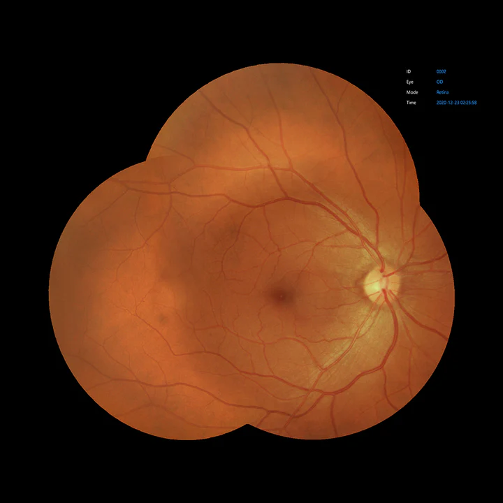 Ezer Cámara Retinal EFC-2600 — vista 18 de 50