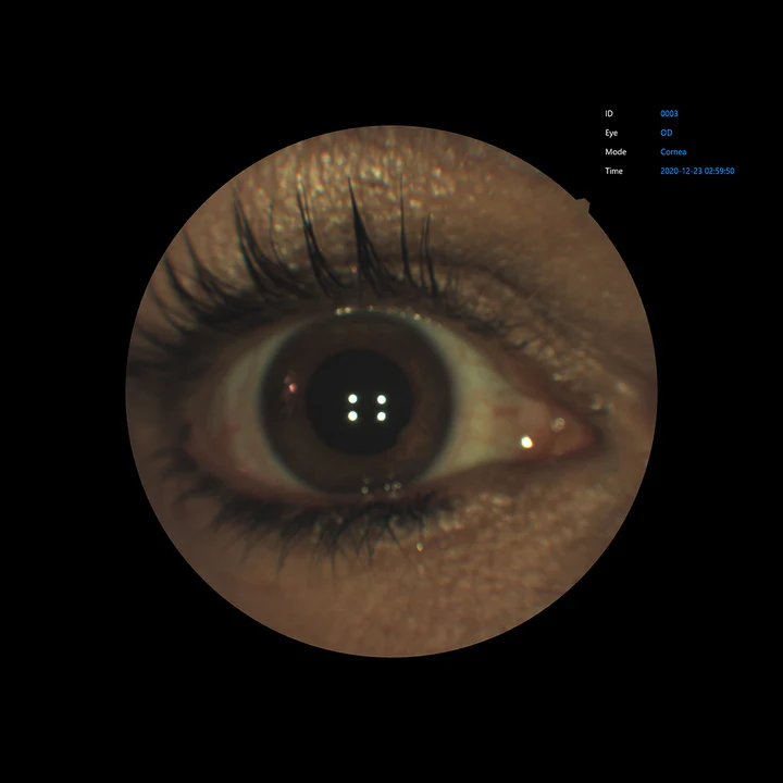 Ezer Cámara Retinal EFC-2600 — vista 12 de 50