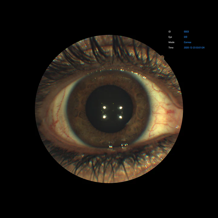 Ezer Cámara Retinal EFC-2600 — vista 10 de 50