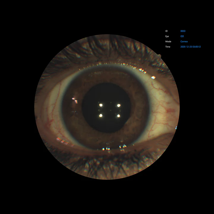 Ezer Cámara Retinal EFC-2600 — vista 9 de 50