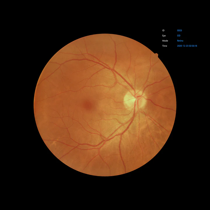 Ezer Cámara Retinal EFC-2600 — vista 5 de 50