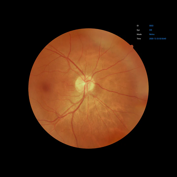 Ezer Cámara Retinal EFC-2600 — vista 4 de 50