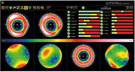 Ezer Topógrafo Corneal Onyx Full — imagen de detalle 7 de 35