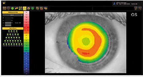 Ezer Topógrafo Corneal Onyx Full — imagen de detalle 8 de 35