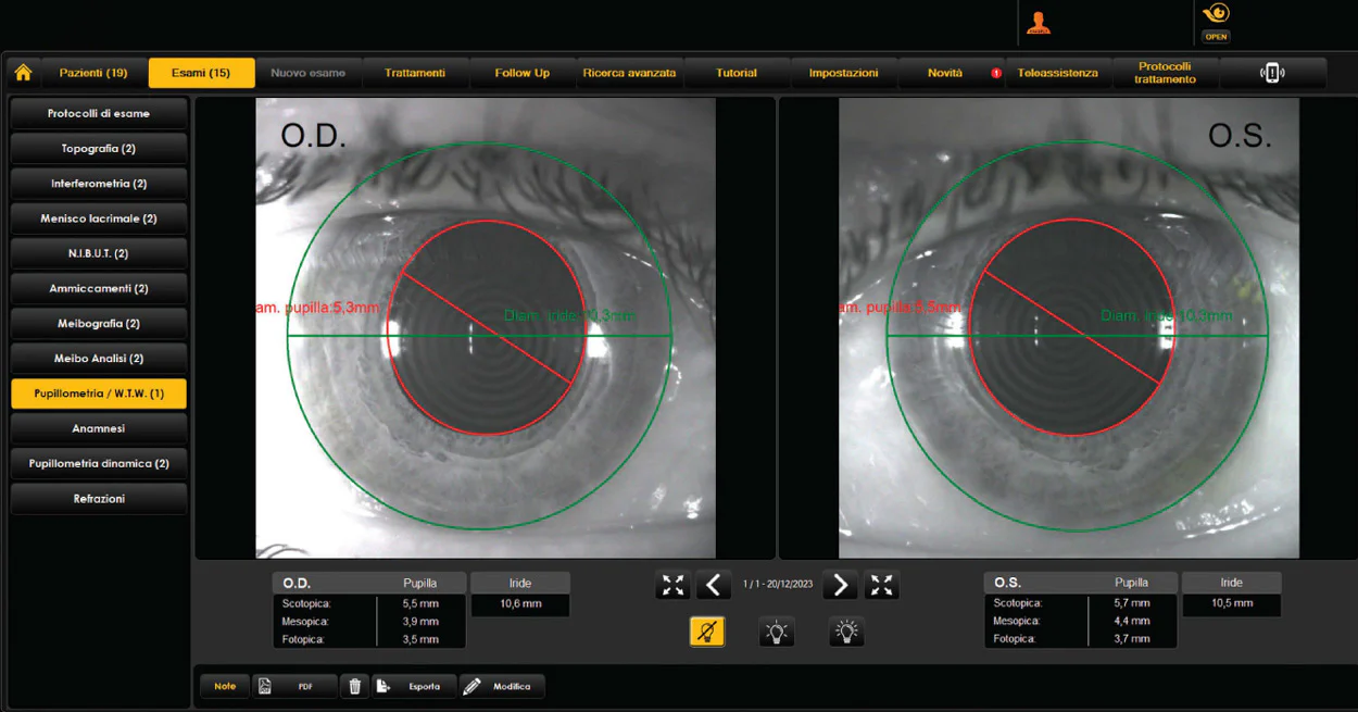 Ezer Topógrafo Corneal Onyx Full — imagen de detalle 12 de 35