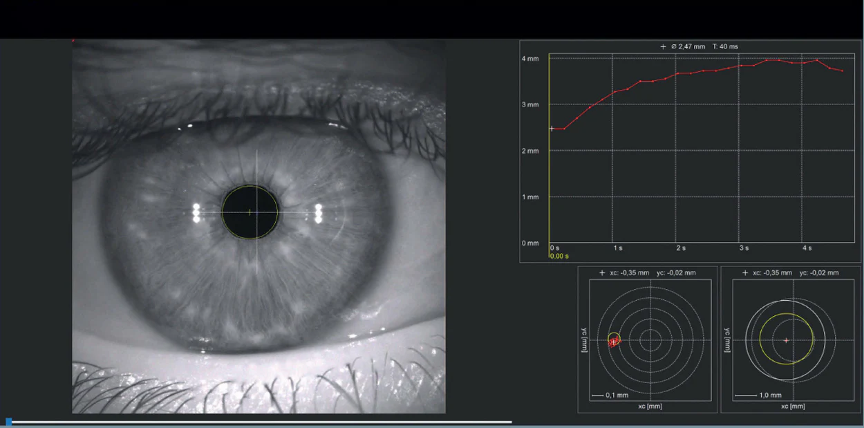 Ezer Topógrafo Corneal Onyx Full — imagen de detalle 13 de 35