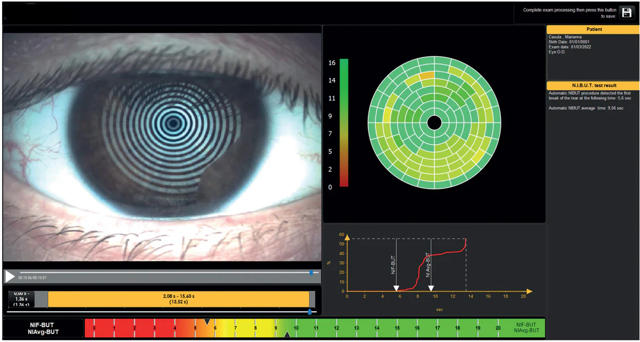 Ezer Topógrafo Corneal Onyx Full — imagen de detalle 15 de 35