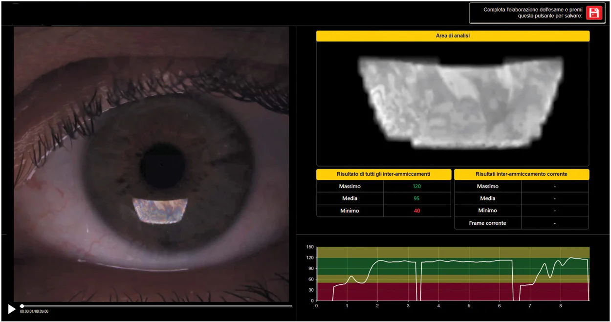 Ezer Topógrafo Corneal Onyx Full — imagen de detalle 16 de 35
