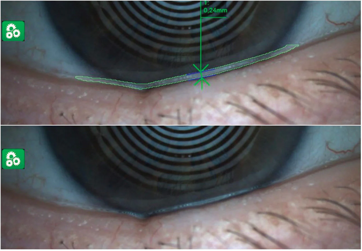 Ezer Topógrafo Corneal Onyx Full — imagen de detalle 17 de 35