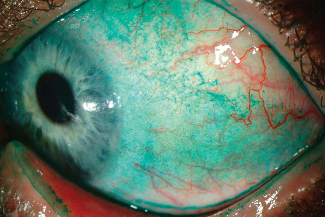 Ezer Topógrafo Corneal Onyx Full — imagen de detalle 18 de 35