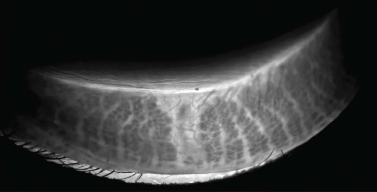 Ezer Topógrafo Corneal Onyx Full — imagen de detalle 20 de 35