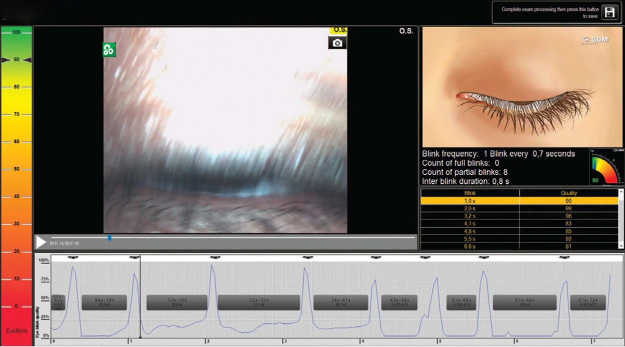 Ezer Topógrafo Corneal Onyx Full — imagen de detalle 22 de 35