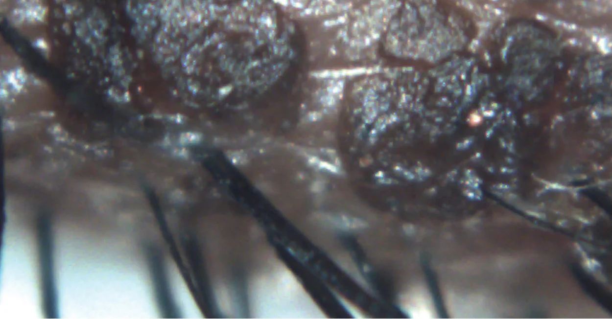Ezer Topógrafo Corneal Onyx Full — imagen de detalle 24 de 35