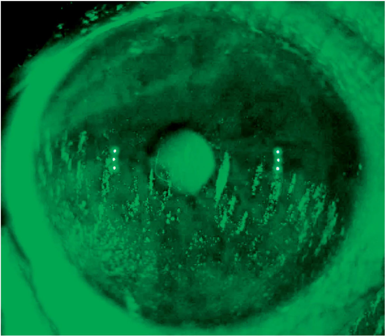Ezer Topógrafo Corneal Onyx Full — imagen de detalle 25 de 35