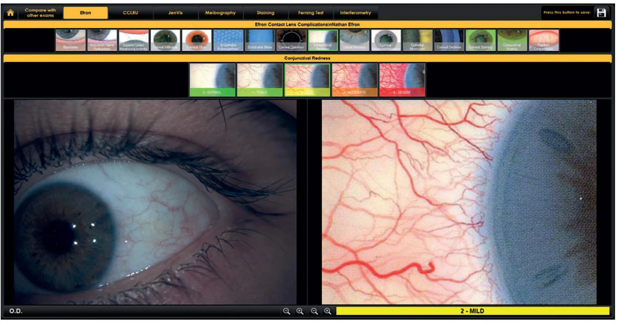 Ezer Topógrafo Corneal Onyx Full — imagen de detalle 27 de 35