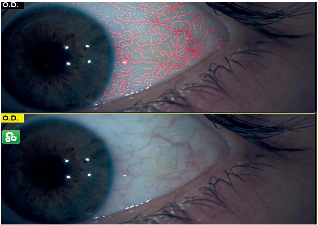 Ezer Topógrafo Corneal Onyx Full — imagen de detalle 26 de 35