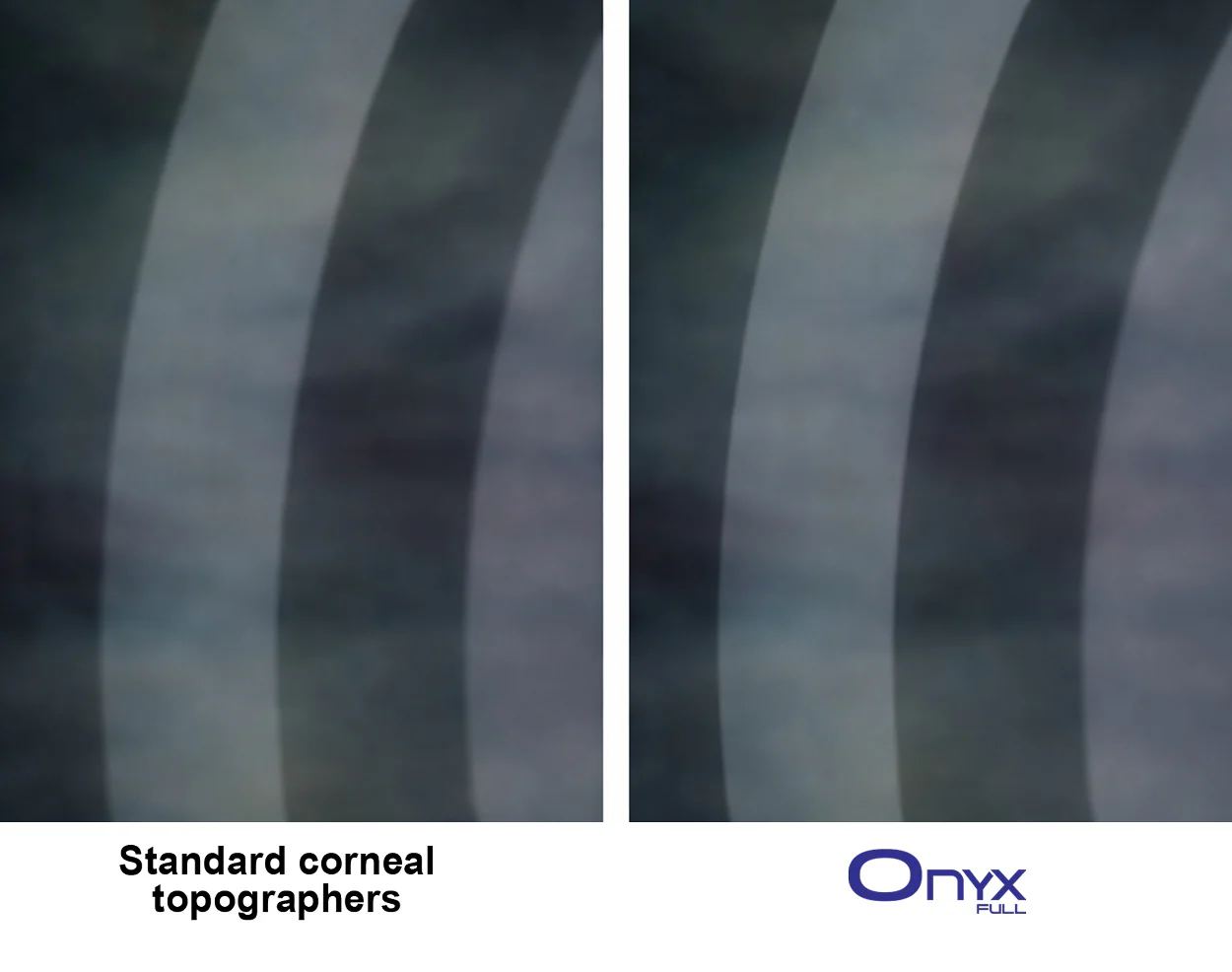 Ezer Topógrafo Corneal Onyx Full