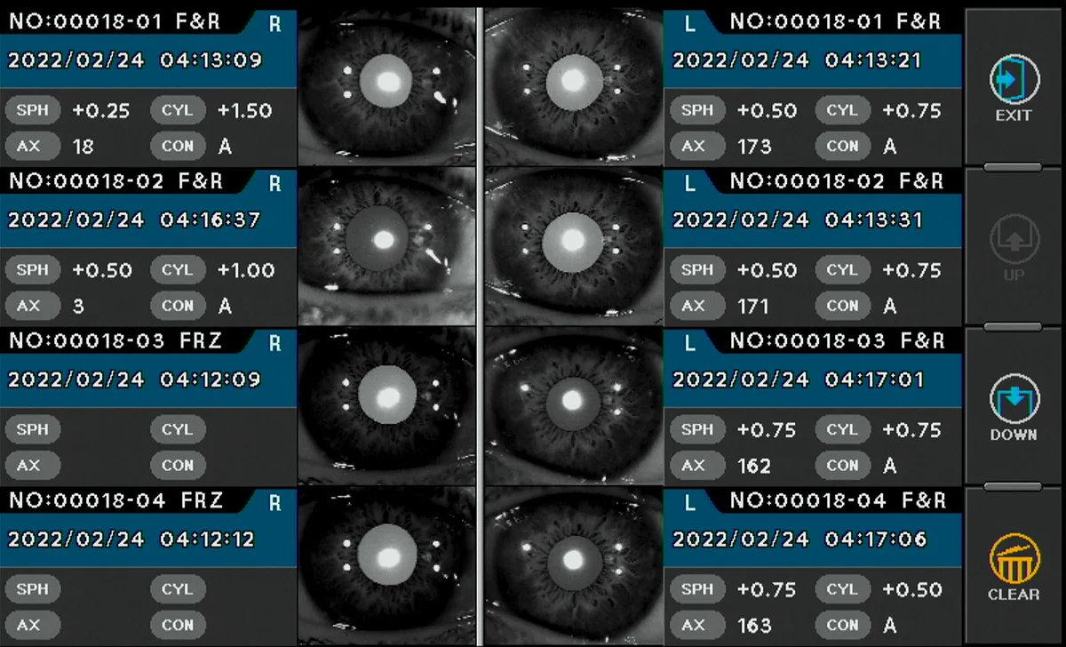 Ezer Autorefractómetro Queratómetro ERK-BH — imagen de detalle 7 de 21