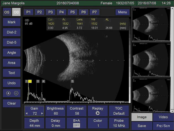 Ezer Escáner Ultrasónico EUS-2600 A/B — imagen de detalle 1 de 6