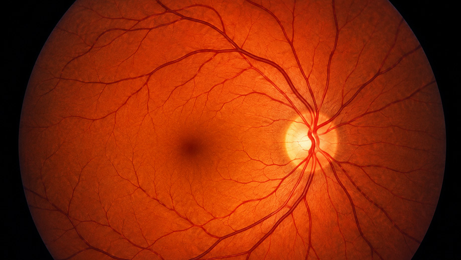 Retina y Fondo de Ojo