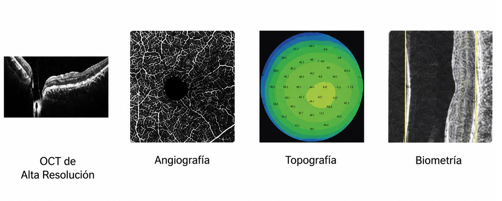 Huvitz Tomógrafo de Coherencia Óptica HOCT-1(80) — imagen de detalle 19 de 19