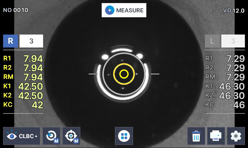 Huvitz Autorrefractor Queratómetro HRK-8100A — imagen de detalle 22 de 24
