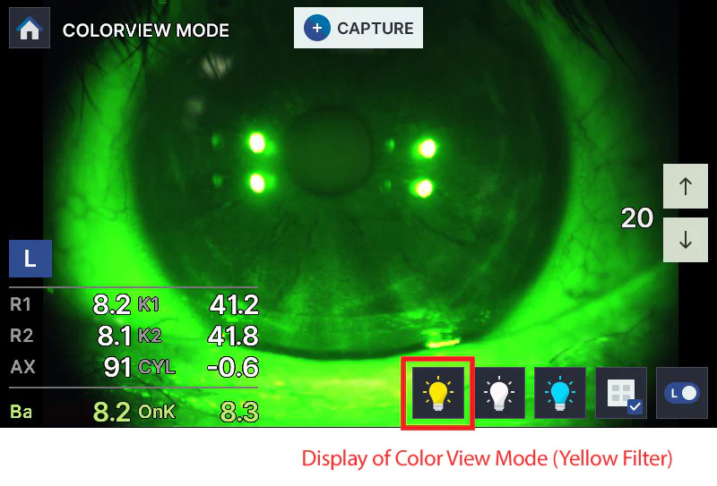 Huvitz Autorrefractor Queratómetro HRK-8100A — imagen de detalle 5 de 24
