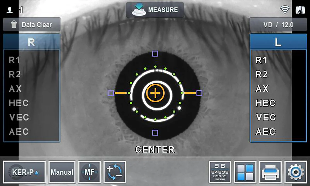 Huvitz Autorrefractor / Queratómetro HRK-9000A — imagen de detalle 8 de 15