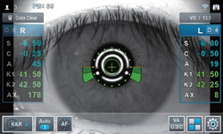 Huvitz Autorrefractor / Queratómetro HRK-9000A — imagen de detalle 11 de 15