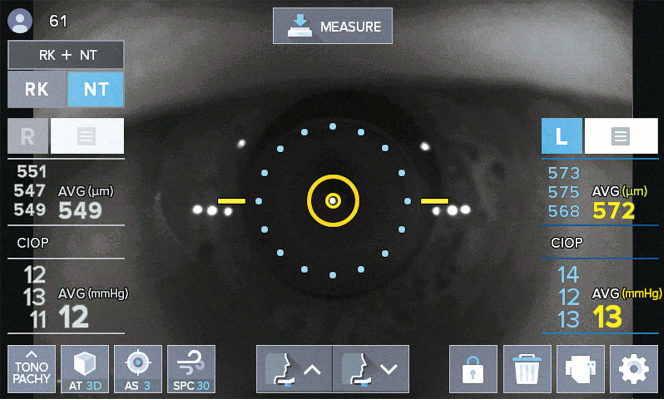 Huvitz Auto Refractor Queratómetro, Tonómetro/Paquímetro sin Contacto HTR-1A — imagen de detalle 10 de 17