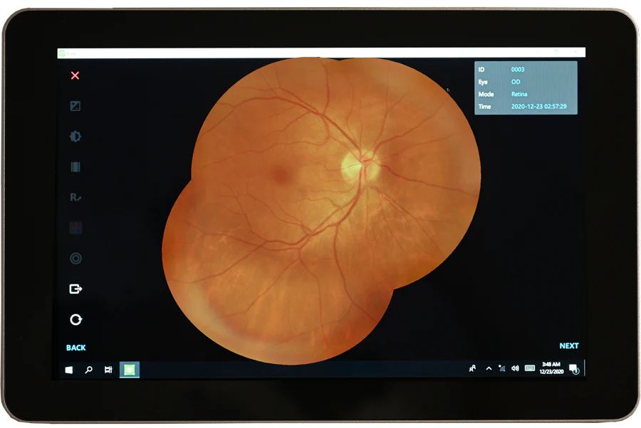 Ezer Cámara Retinal EFC-2600 — imagen de detalle 2 de 23