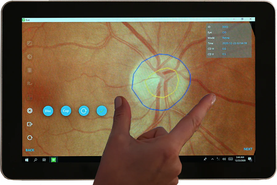 Ezer Cámara Retinal EFC-2600 — imagen de detalle 4 de 23